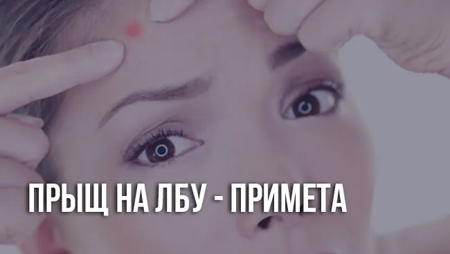 Прыщ на лбу примета